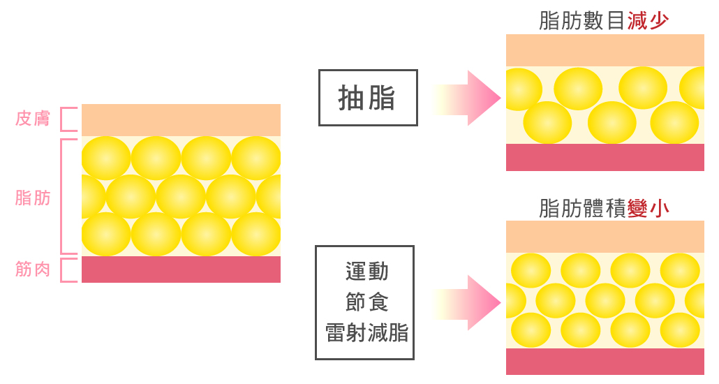 重點要減少脂肪細胞