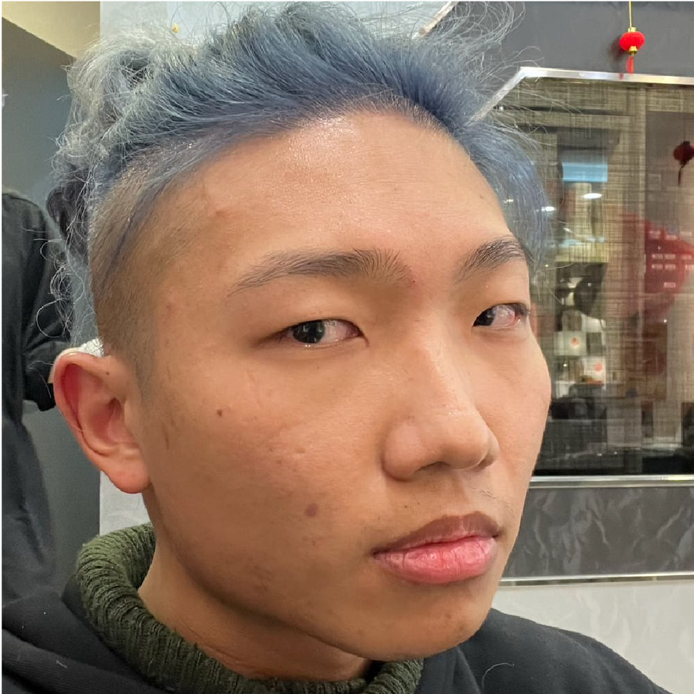 隆鼻割雙眼皮墊下巴前的我1