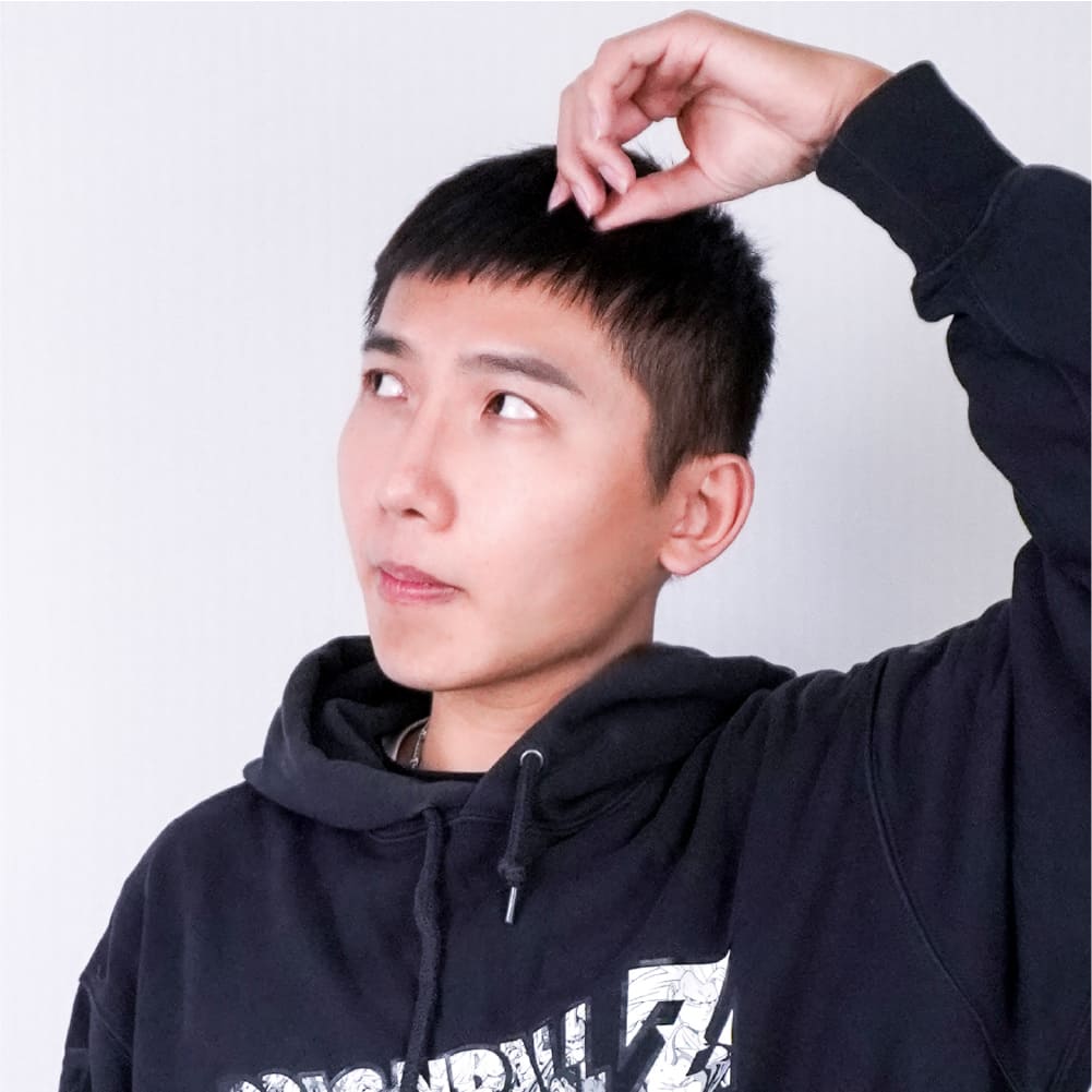 台南白璧割雙眼皮墊下巴隆鼻術後照3