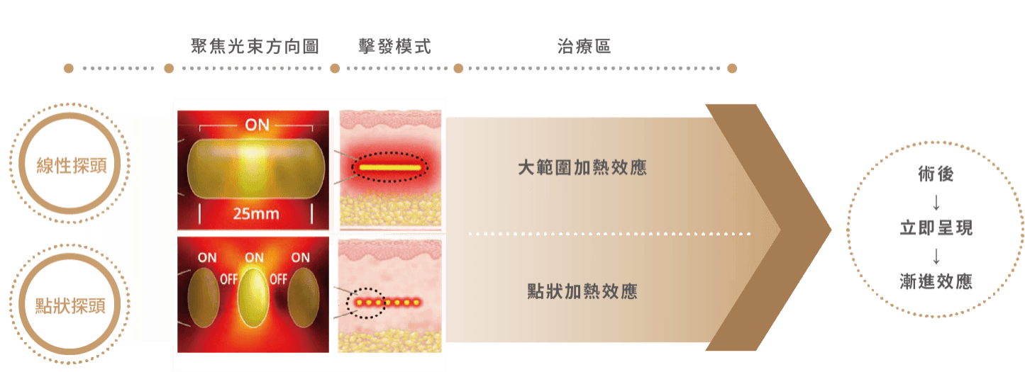 Q+立線音波的兩種作用探頭