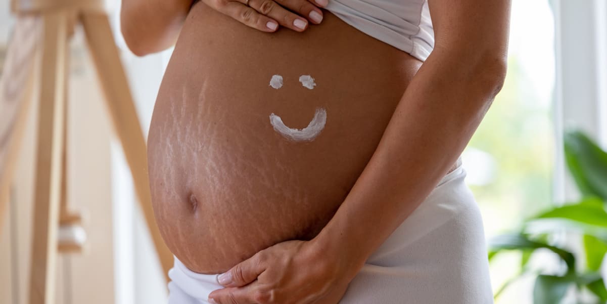 懷孕時從皮膚到腹直肌都會被撐大產生妊娠紋
