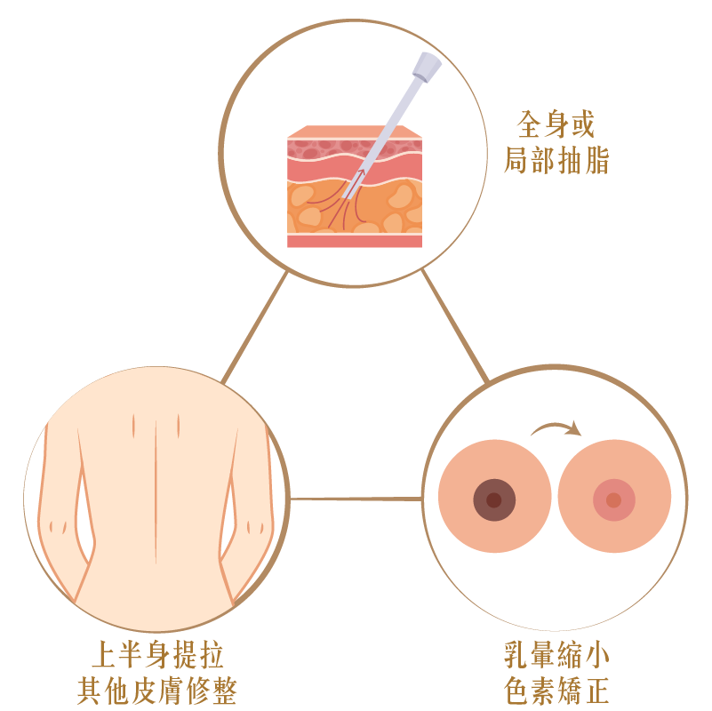 女乳症可以和哪些手術併行