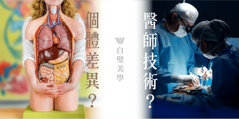 隆乳神經修復跟個體差異影響最大