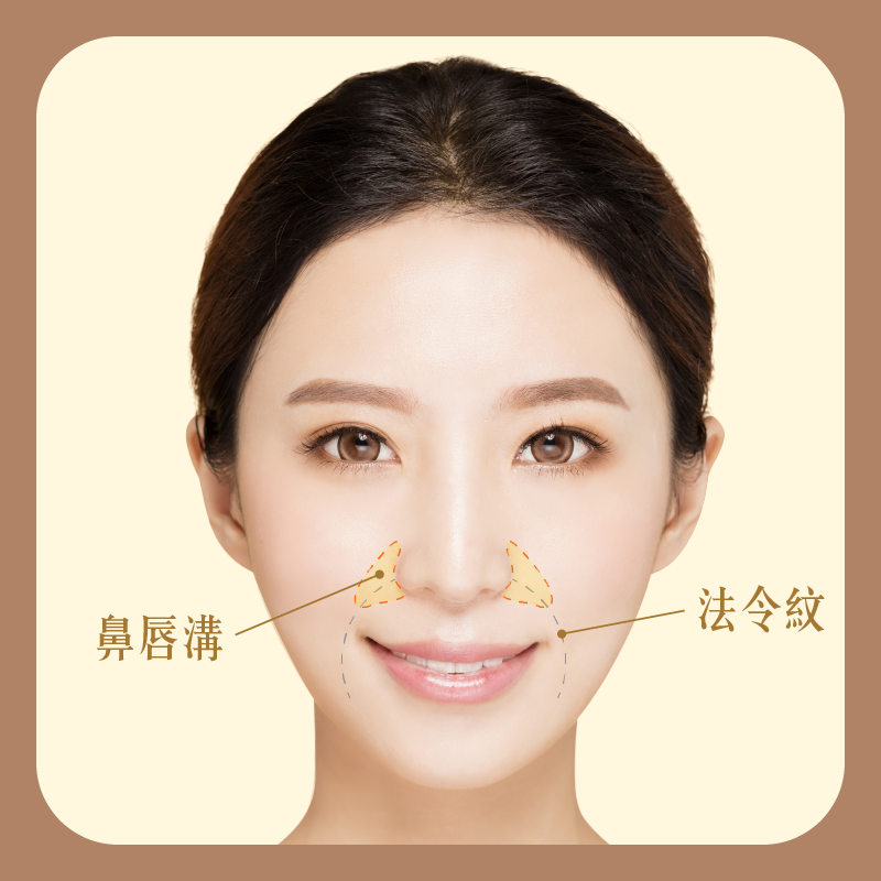 鼻唇溝位置在哪？