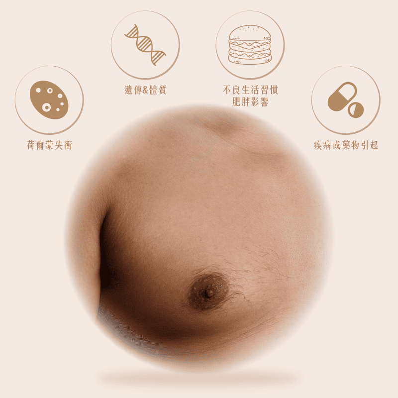 男性女乳症成因M