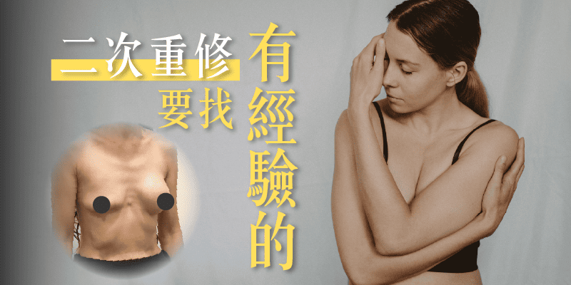 二次隆乳重修要找有經驗的整外醫師