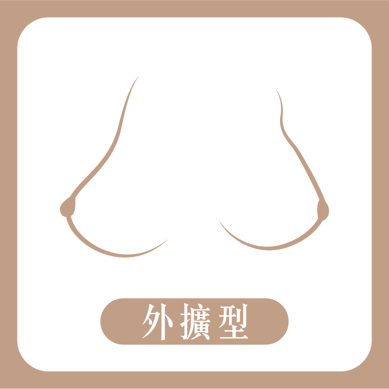 外擴型胸型