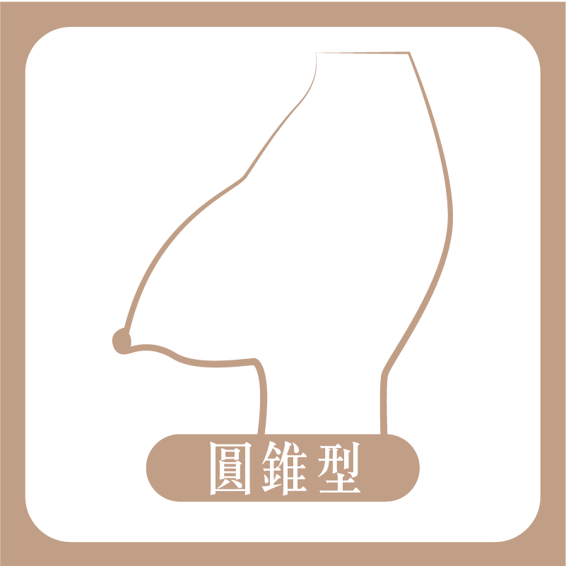 錐形胸型