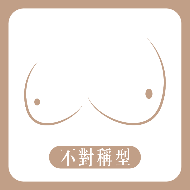 不對稱胸型