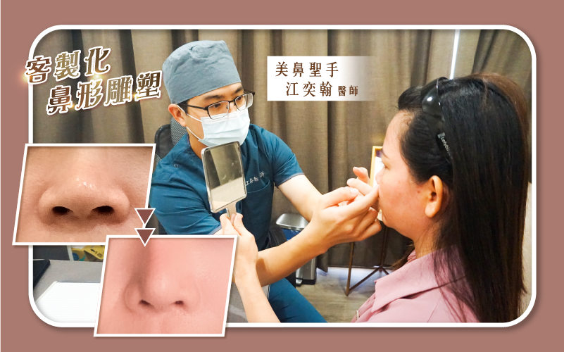 縮鼻頭手術建議由有經驗的整外醫師進行-1