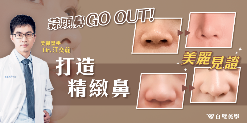 【縮鼻翼】鼻翼肥大/蒜頭鼻的隱痕鼻翼縮小需求-白璧美學