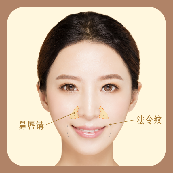 鼻唇溝與法令紋的差異