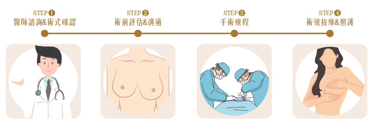 隆乳重修的流程