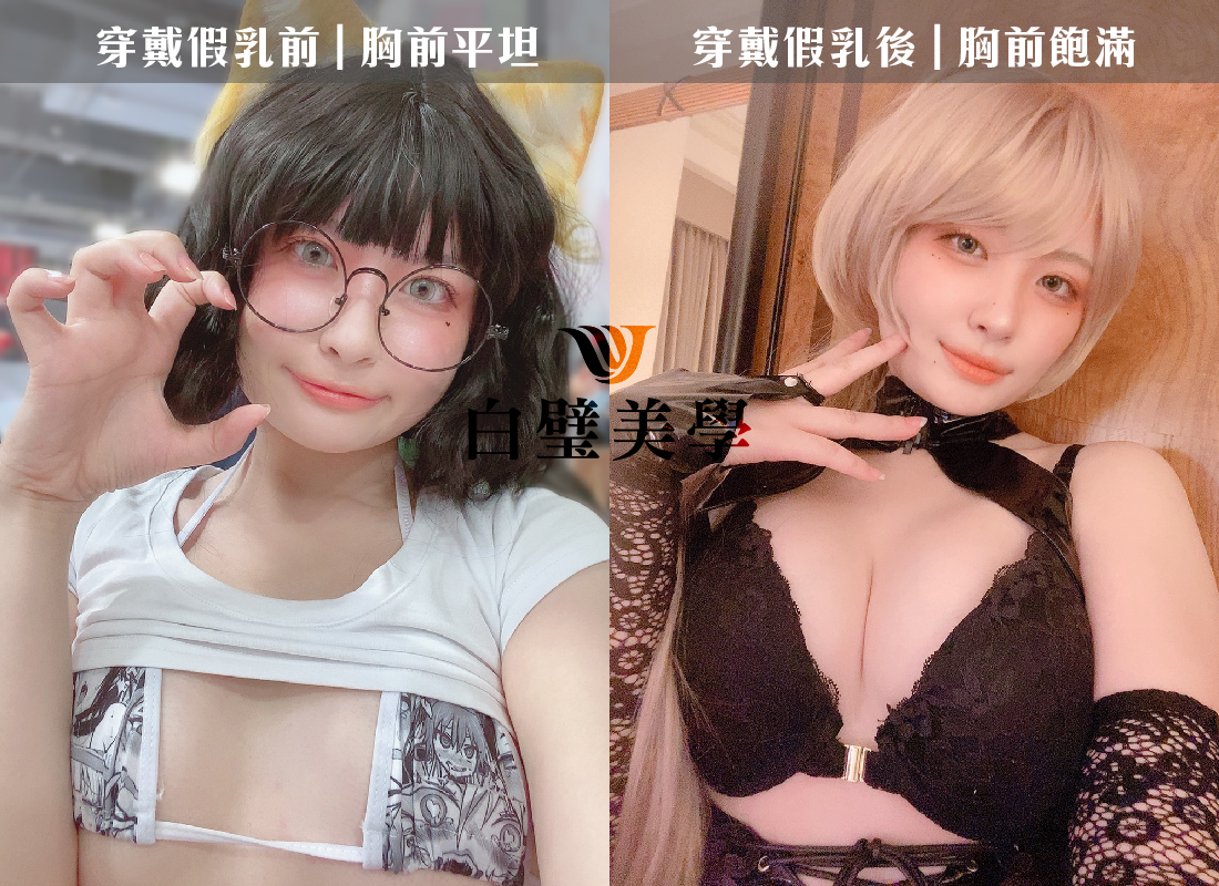 隆乳前總覺得裝扮上少了什麼