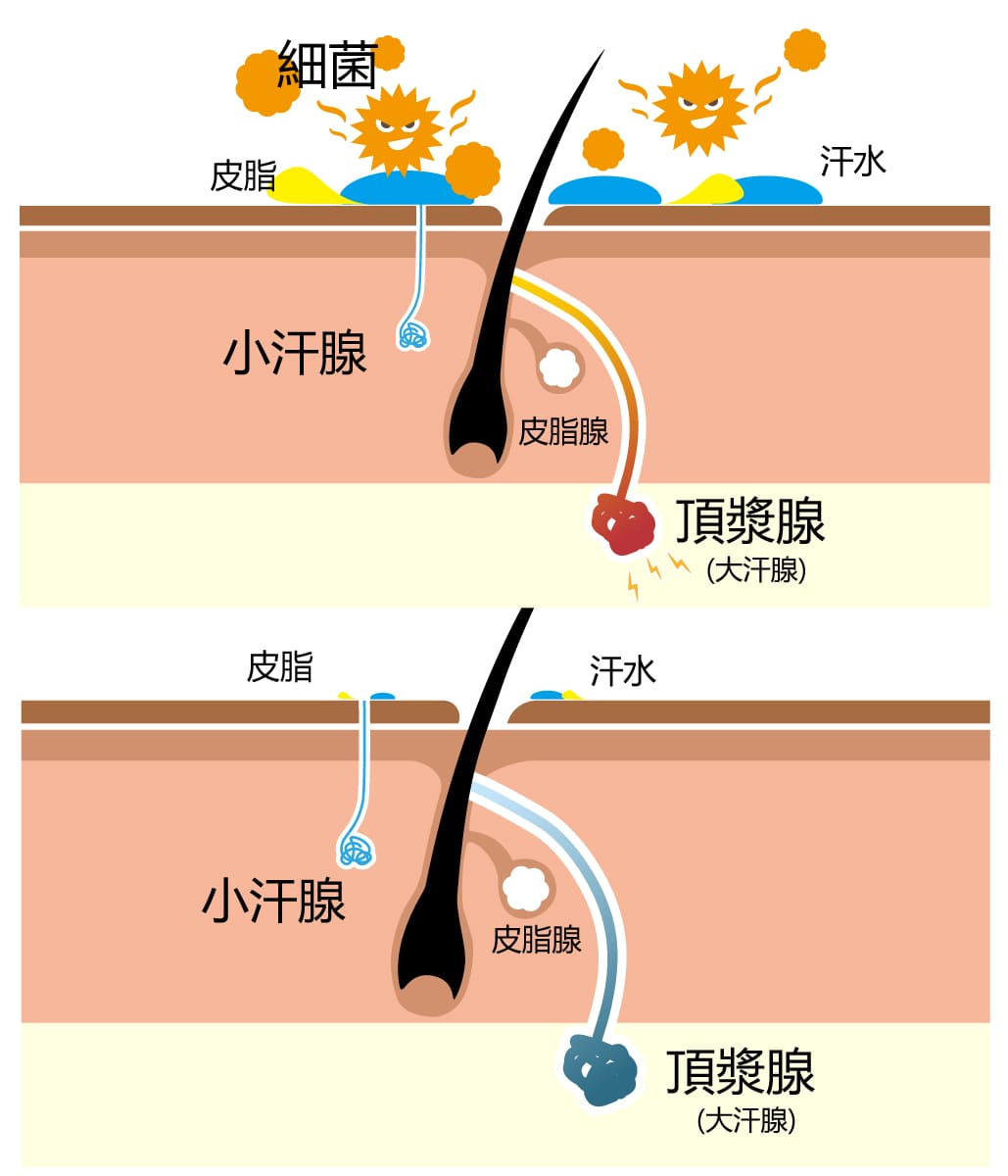 為何注射肉毒桿菌素能止汗M