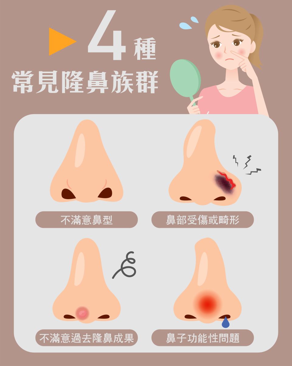 常見的4種隆鼻原因