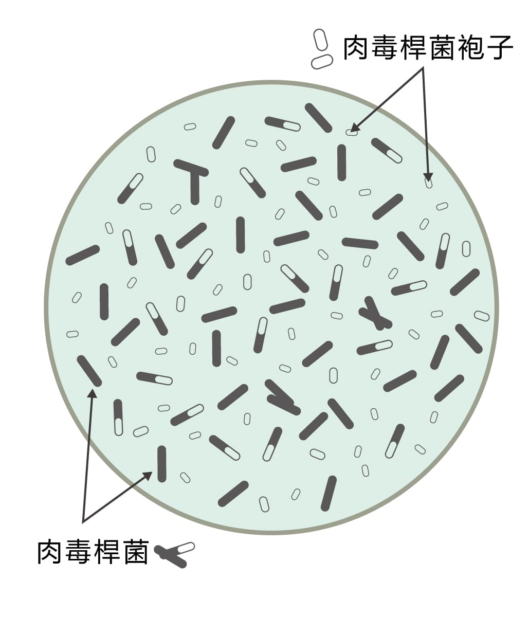 肉毒桿菌素是什麼.真的有毒嗎M