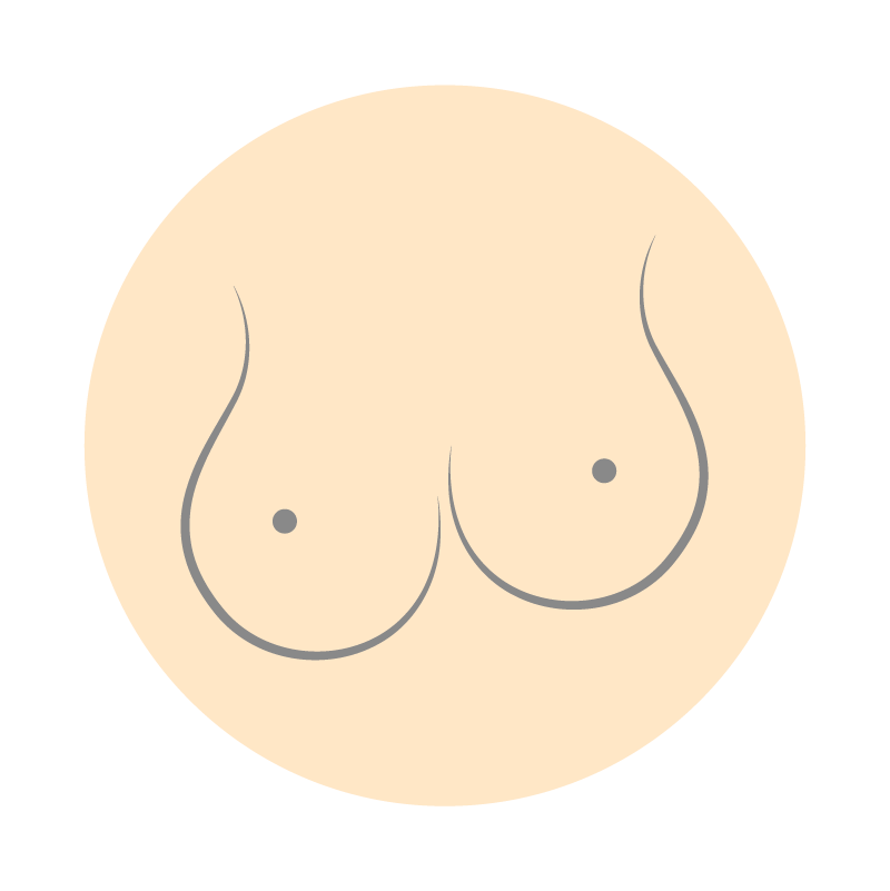 M隆乳重修狀況 ：胸部兩邊不對稱