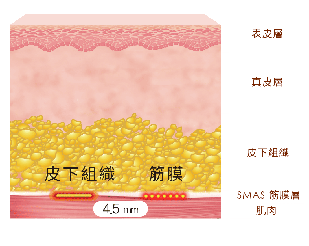 Q+立線音波探頭-白璧美學-2