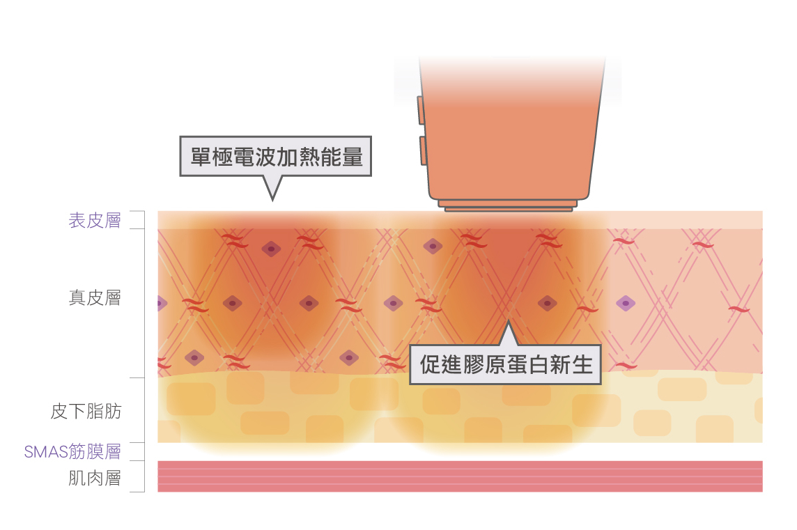 單極電波原理